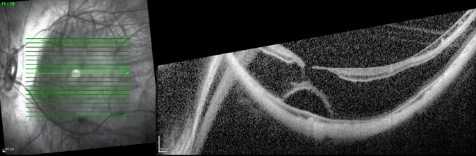 Screen Shot 2017-09-12 at 6.13.43 PM