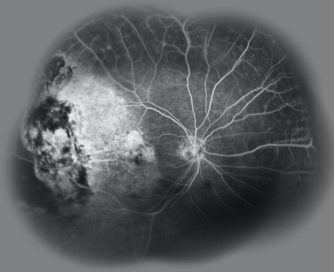 Screen Shot 2017-09-12 at 6.14.11 PM